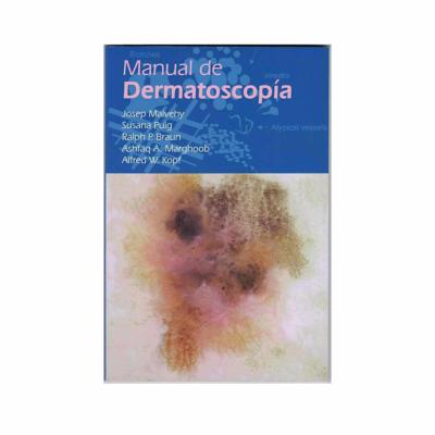 Manual de Dermatoscopia